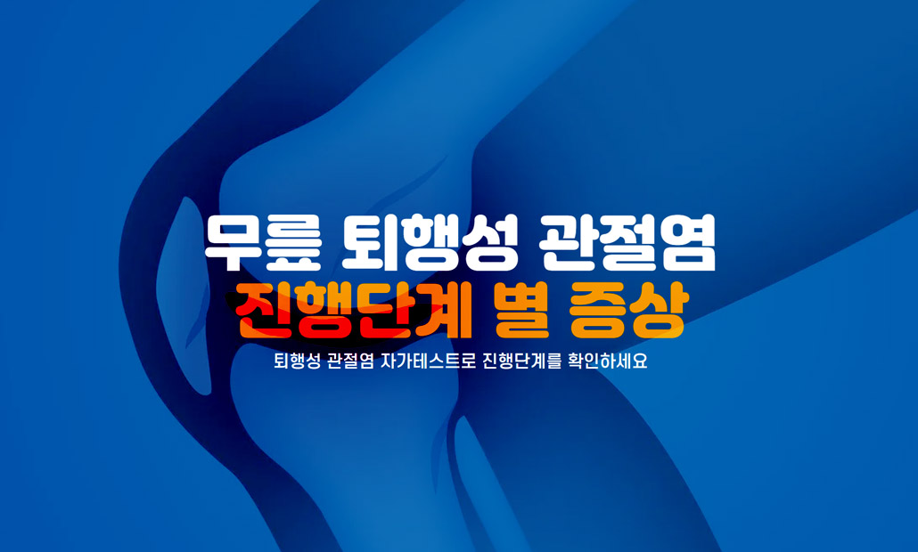 퇴행성 관절염 진행단계.jpg