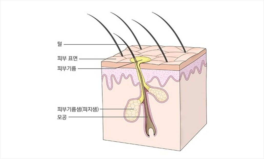 모공.jpg