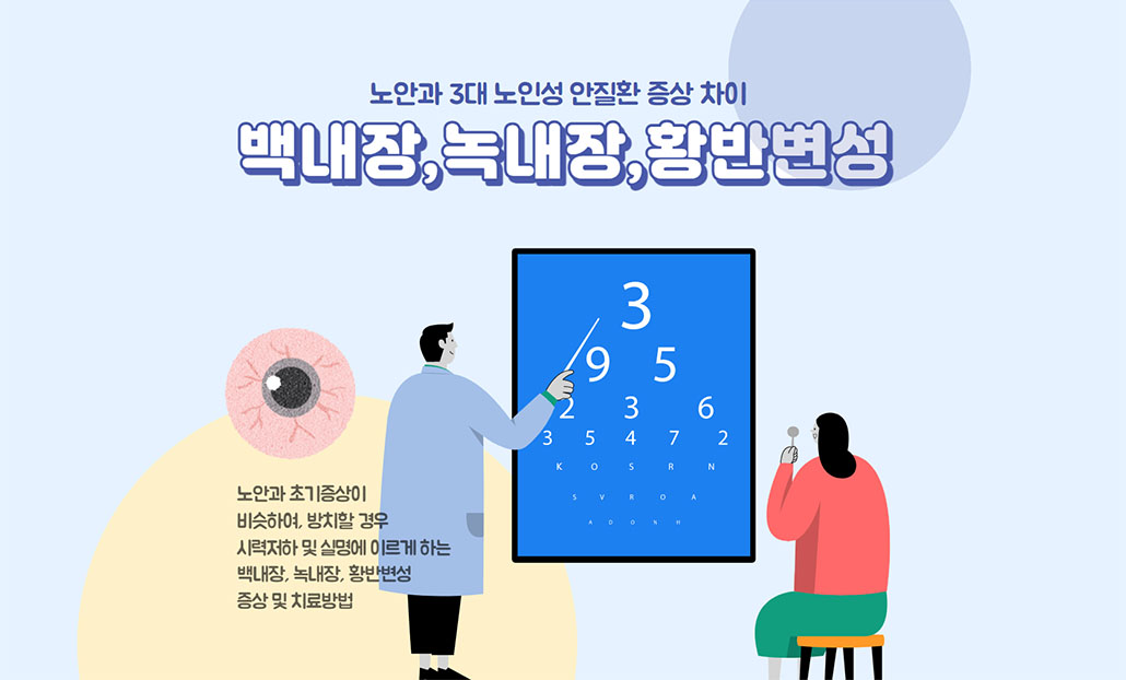 백내장 녹내장 황반변성 눈건강.jpg