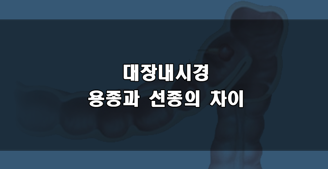 대장내시경 용종과 선종.png