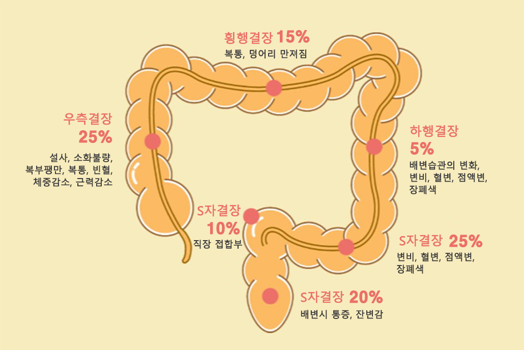 대장암 위치별 증상.jpg