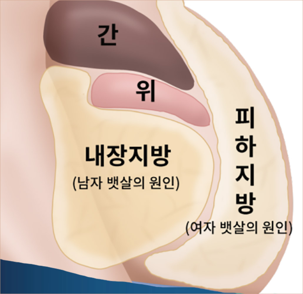 피하지방 내장지방 위치.jpg