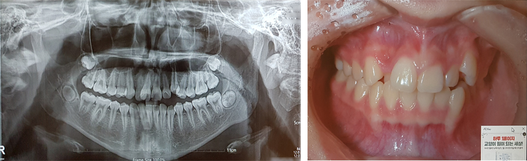 치아교정 검진.jpg