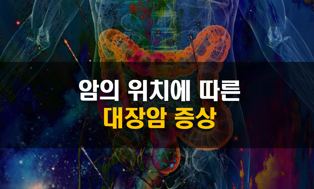 대장암 증상.jpg