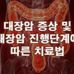 대장암 증상 및 진행단계에 따른 치료법