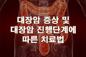 대장암 증상 및 진행단계