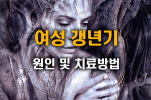 여성 갱년기 원인 및 치료방법 (호르몬치료 효과 부작용 및 대안)